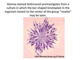 Giemsa stained leishmanial promastigotes from a
culture in which the bar-shaped kinetoplast in the
organism closest to the center of the group "rosette“
may be seen.
 
