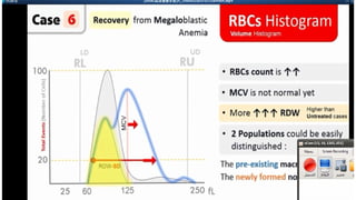 Blood Cell Histograms modified hematology.pptx