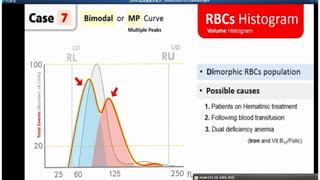 Blood Cell Histograms modified hematology.pptx
