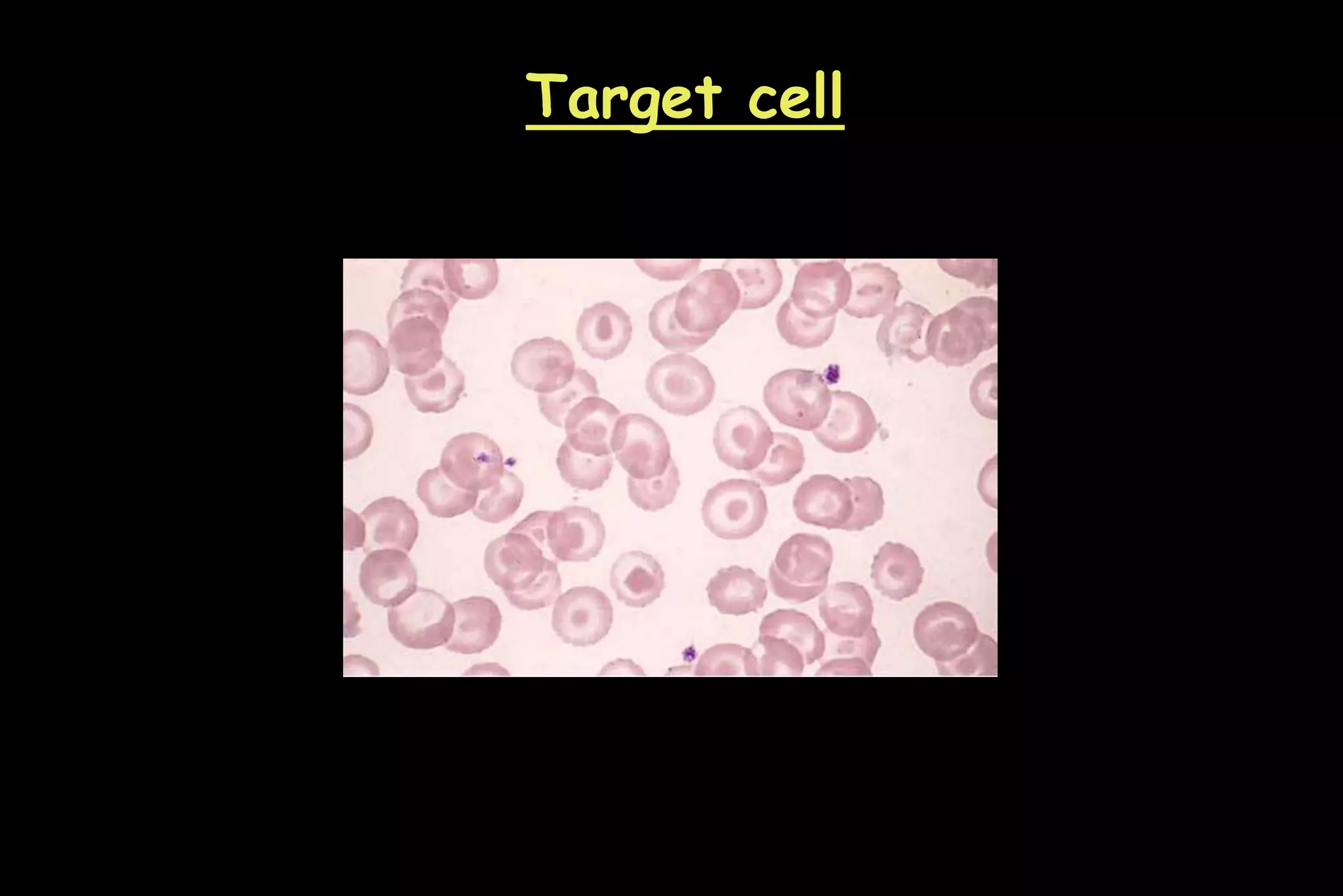 Target cell
 