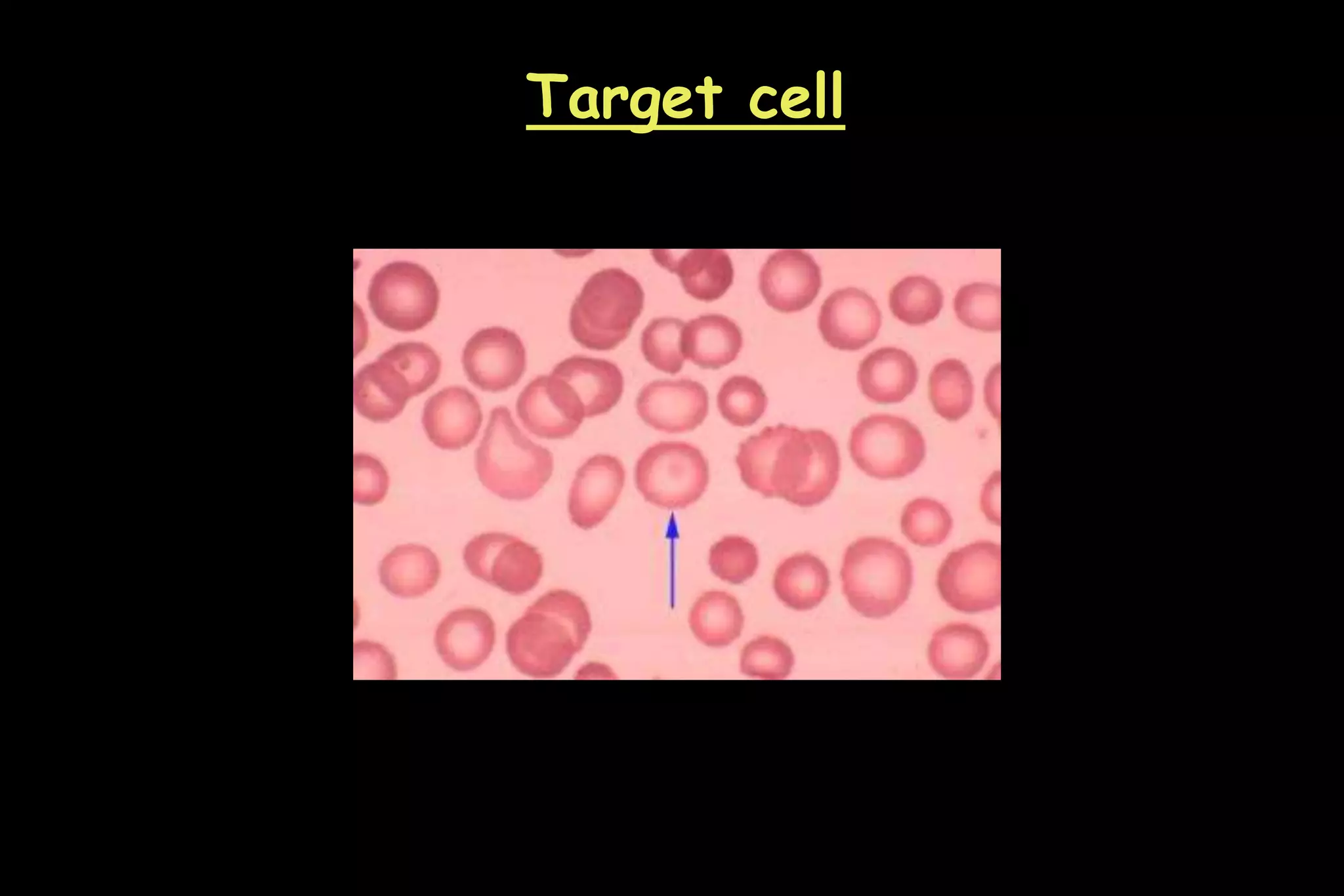 Target cell
 