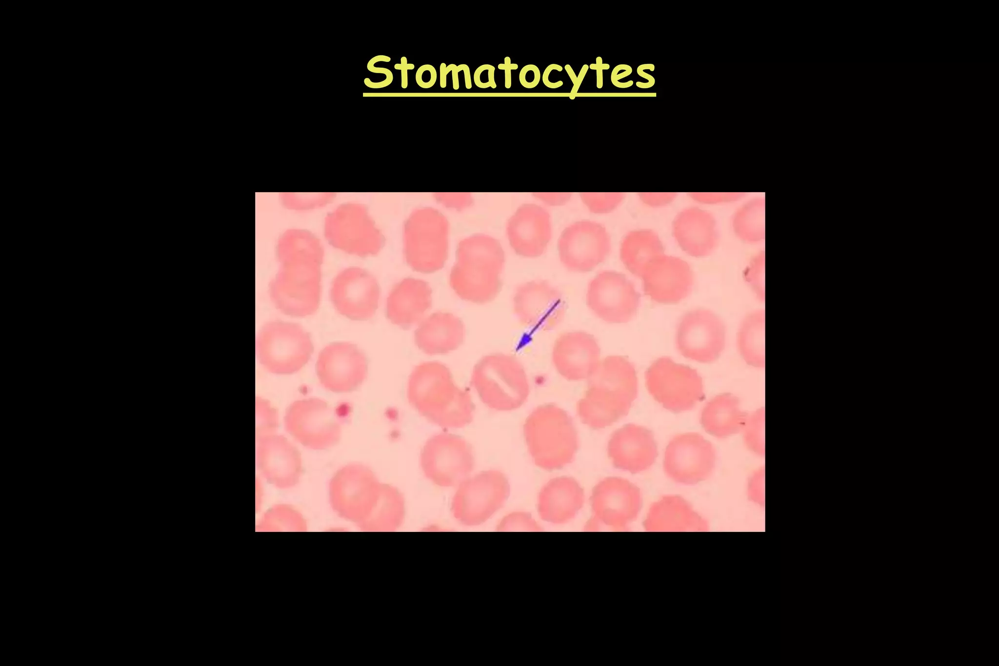 Stomatocytes
 