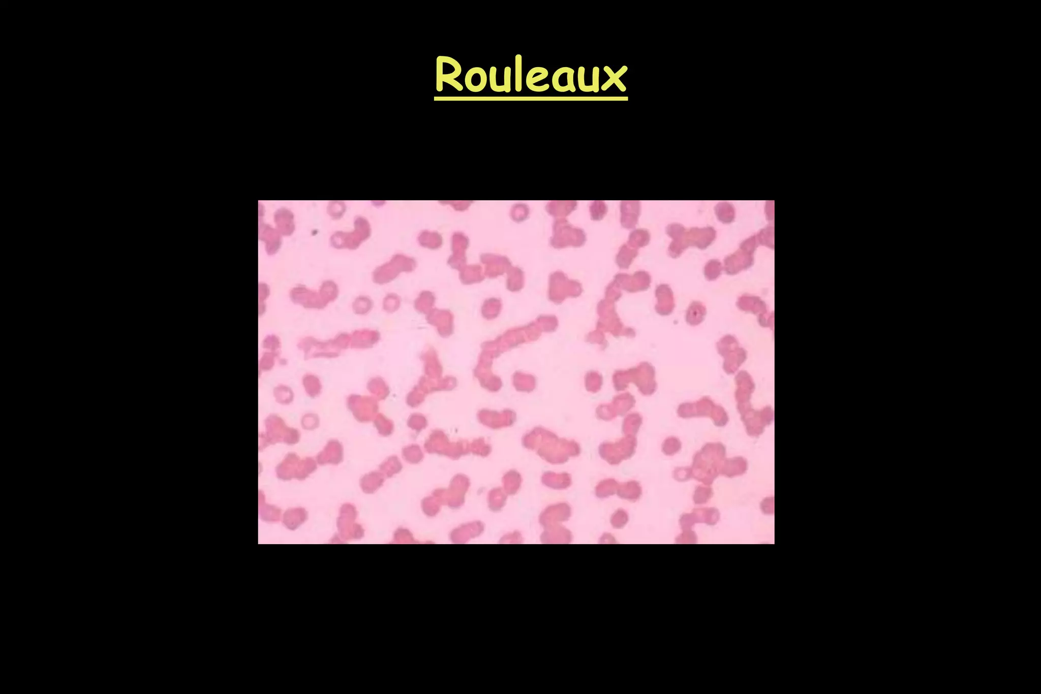 Rouleaux
 