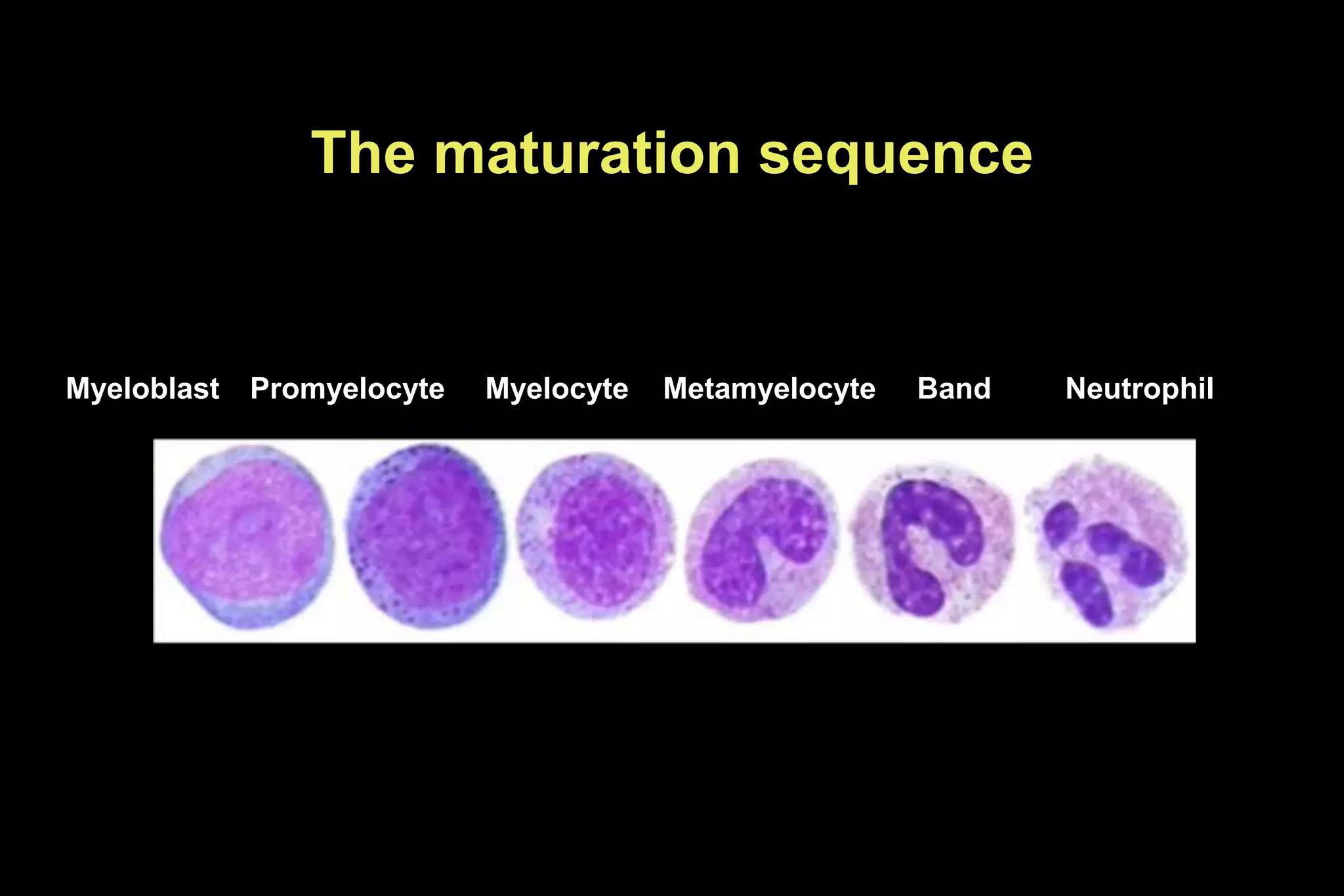 The maturation sequence
Myeloblast Promyelocyte Myelocyte Metamyelocyte Band Neutrophil
 