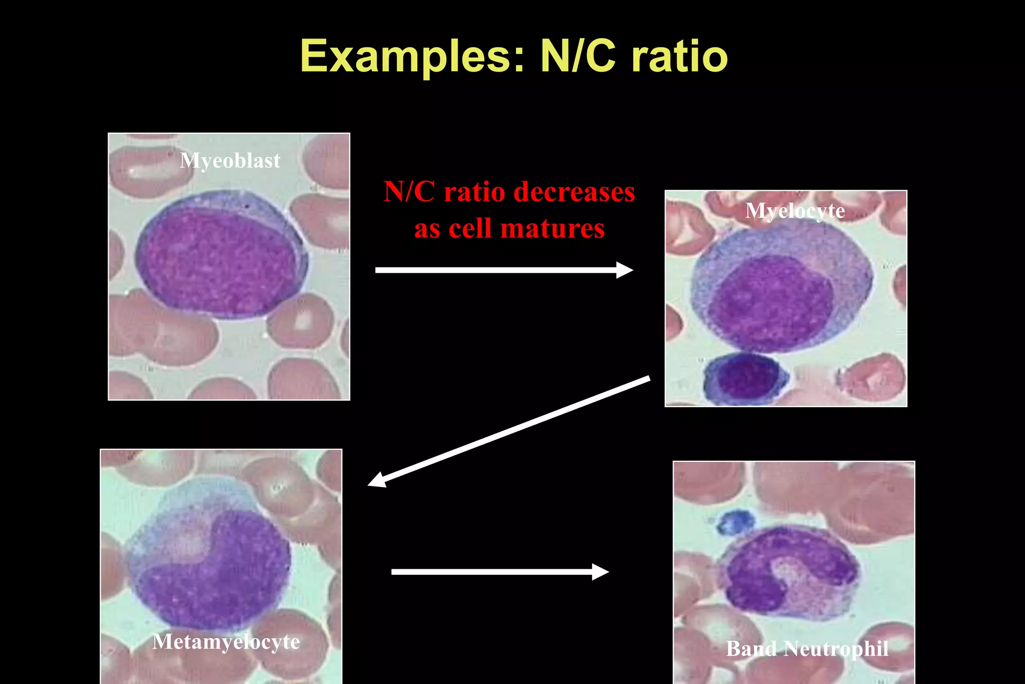 Examples: N/C ratio
N/C ratio decreases
as cell matures
Myeoblast
Myelocyte
Metamyelocyte Band Neutrophil
 