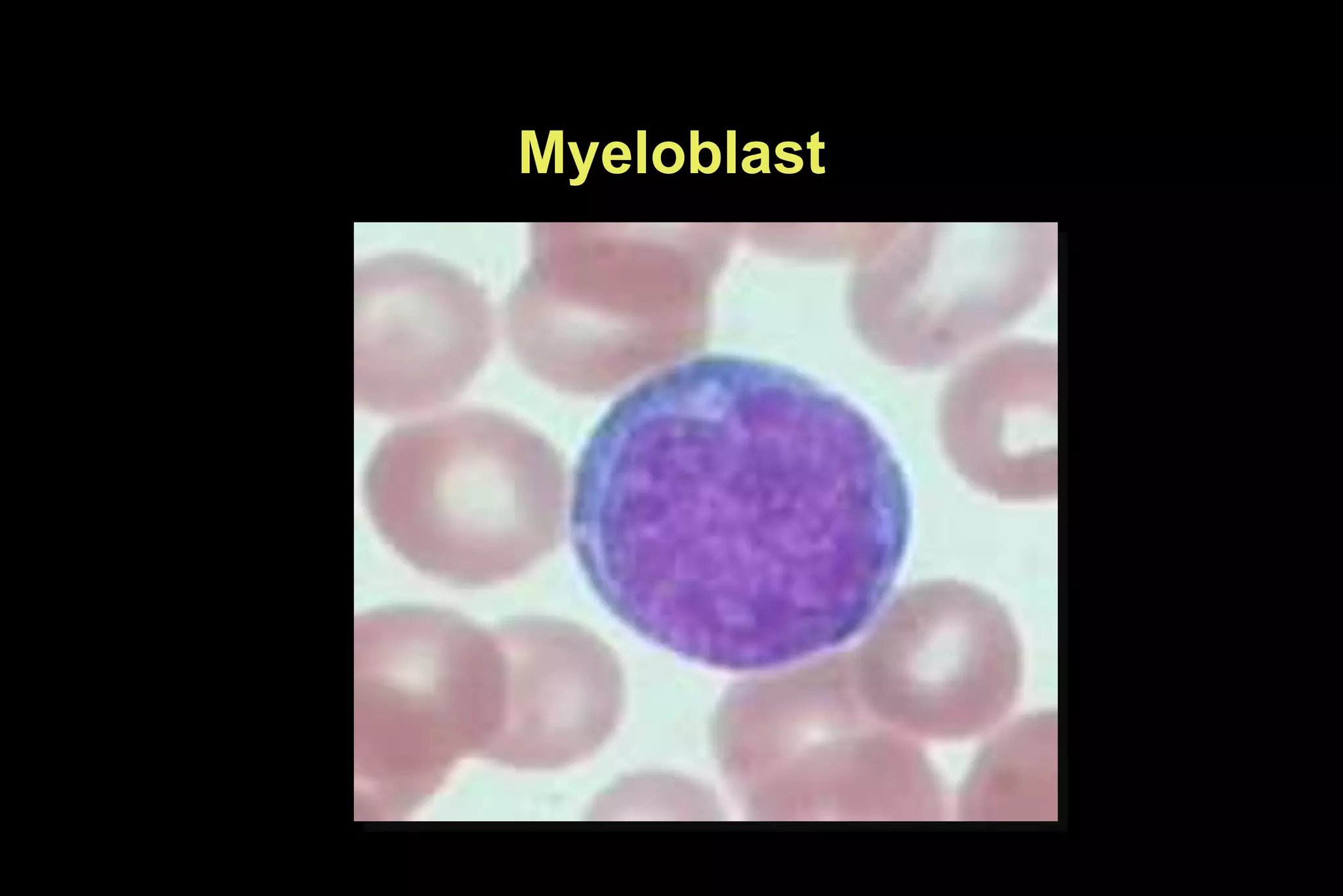 Myeloblast
 