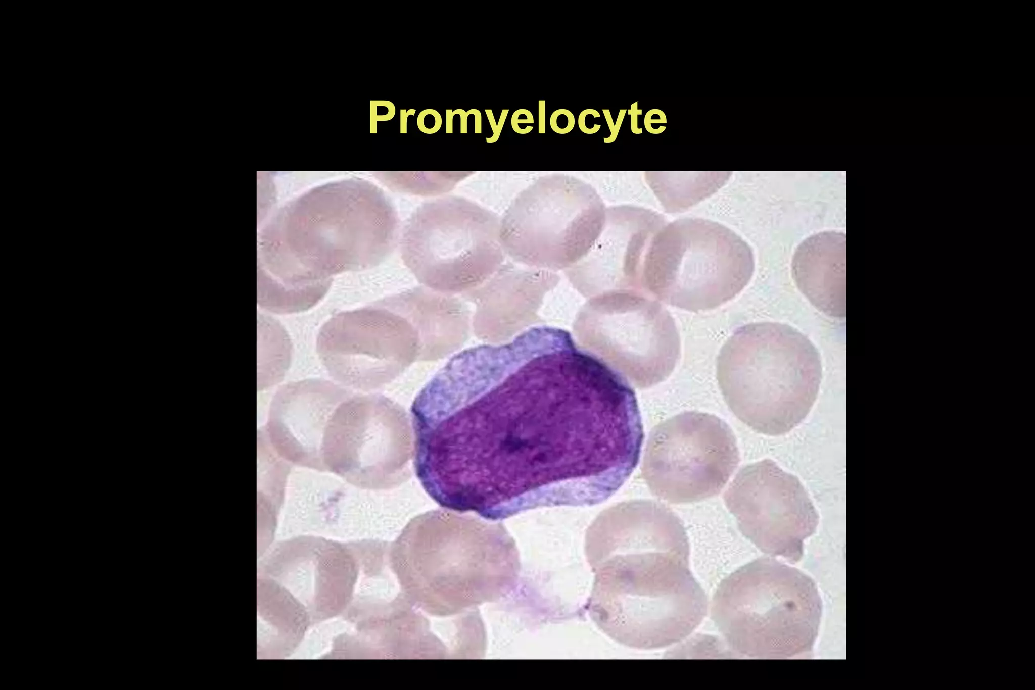 Promyelocyte
 