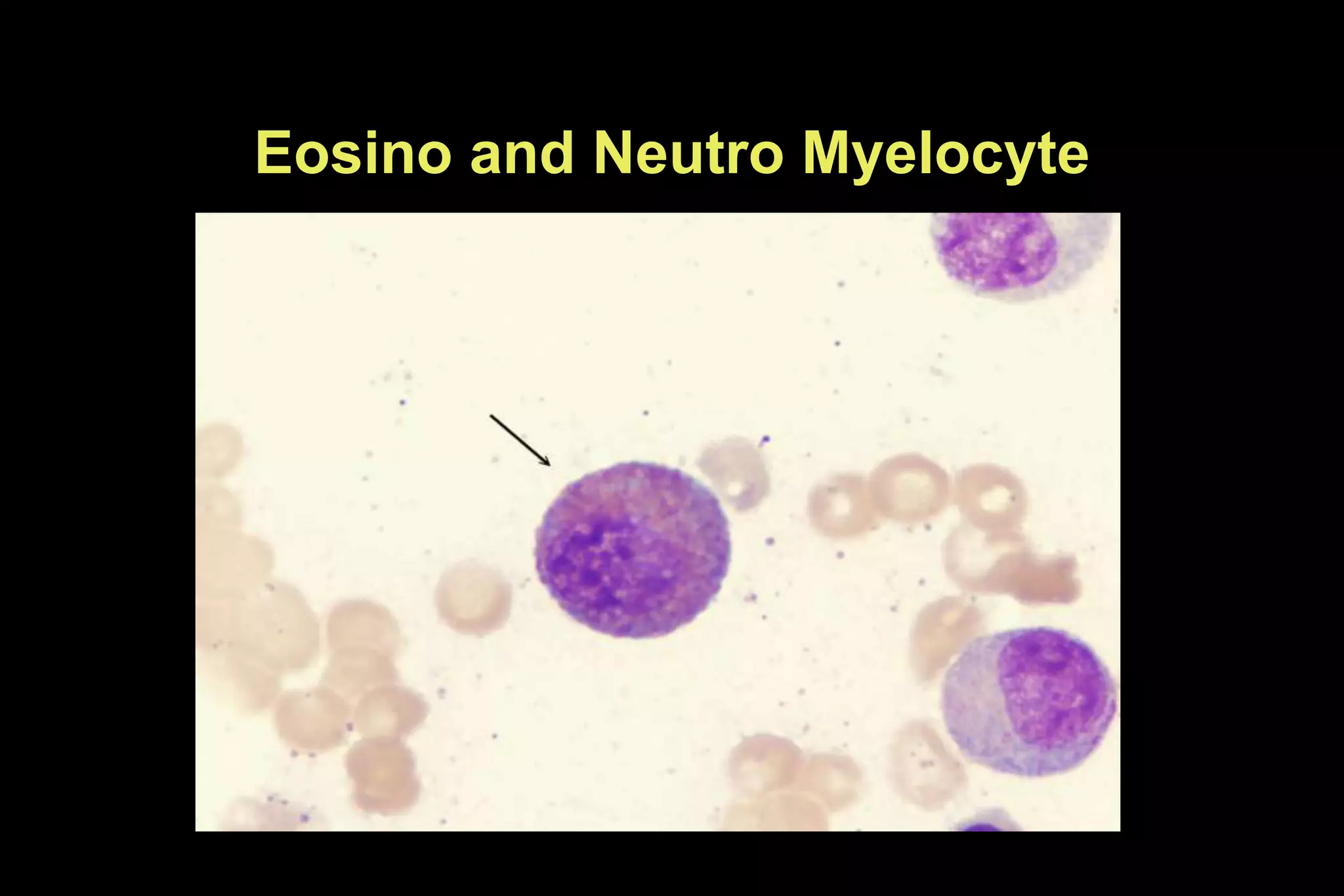 Eosino and Neutro Myelocyte
 