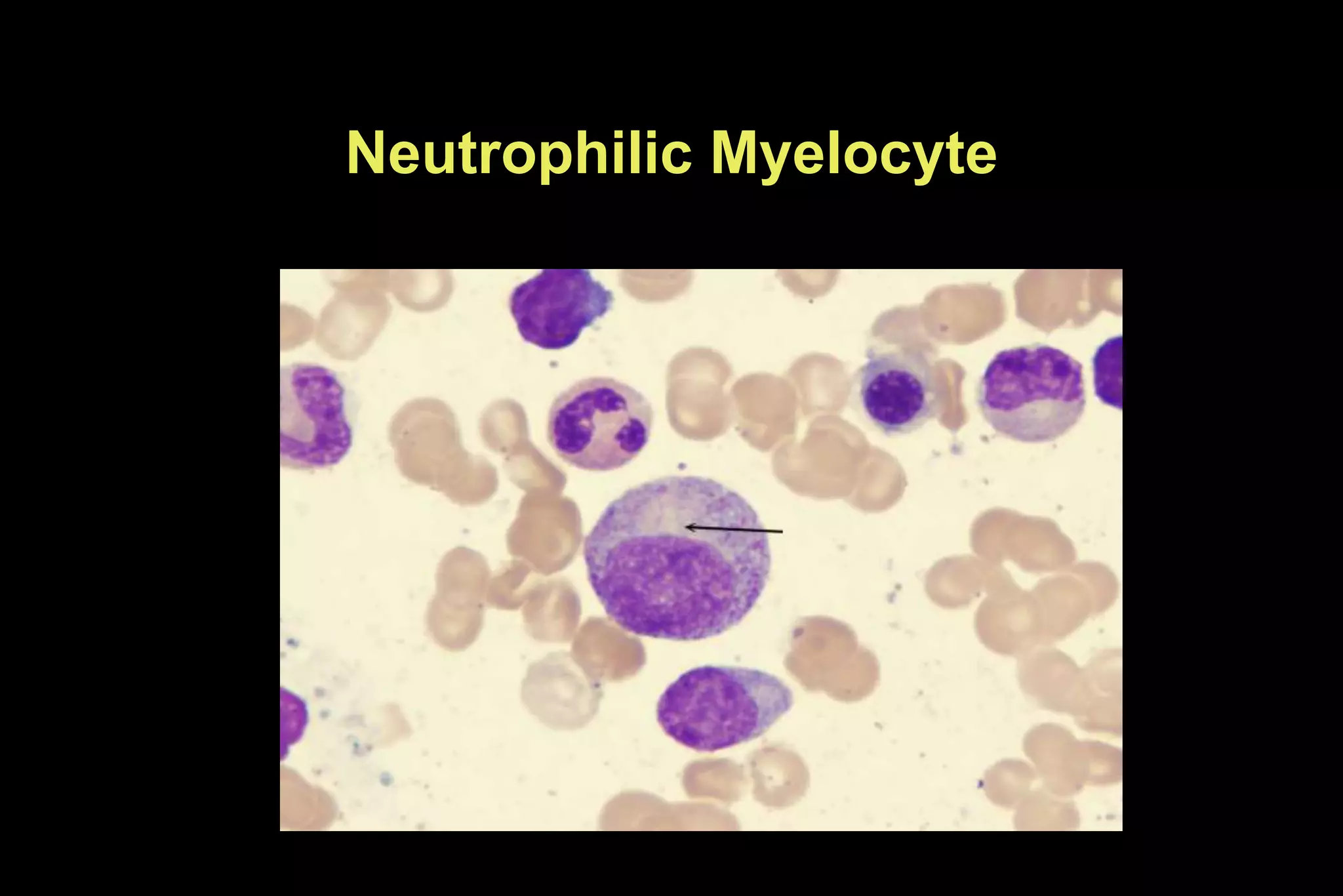 Neutrophilic Myelocyte
 