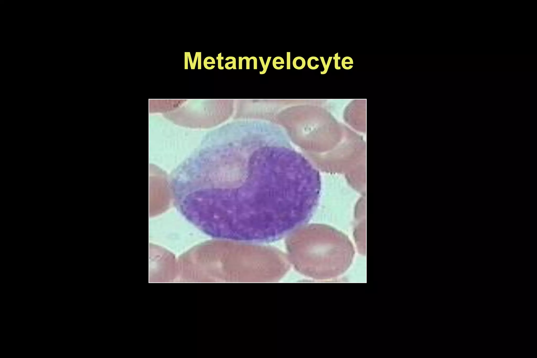 Metamyelocyte
 