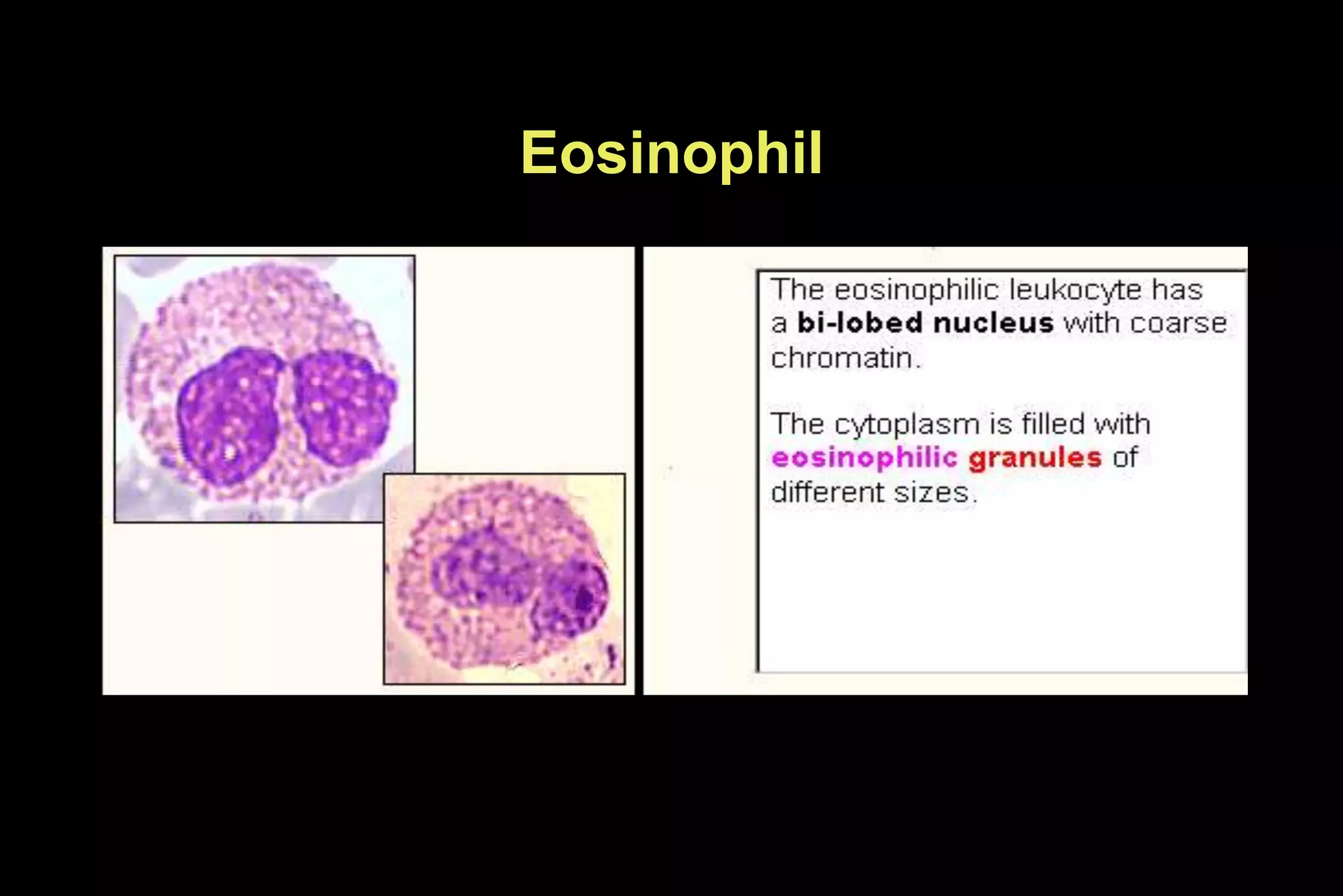 Eosinophil
 