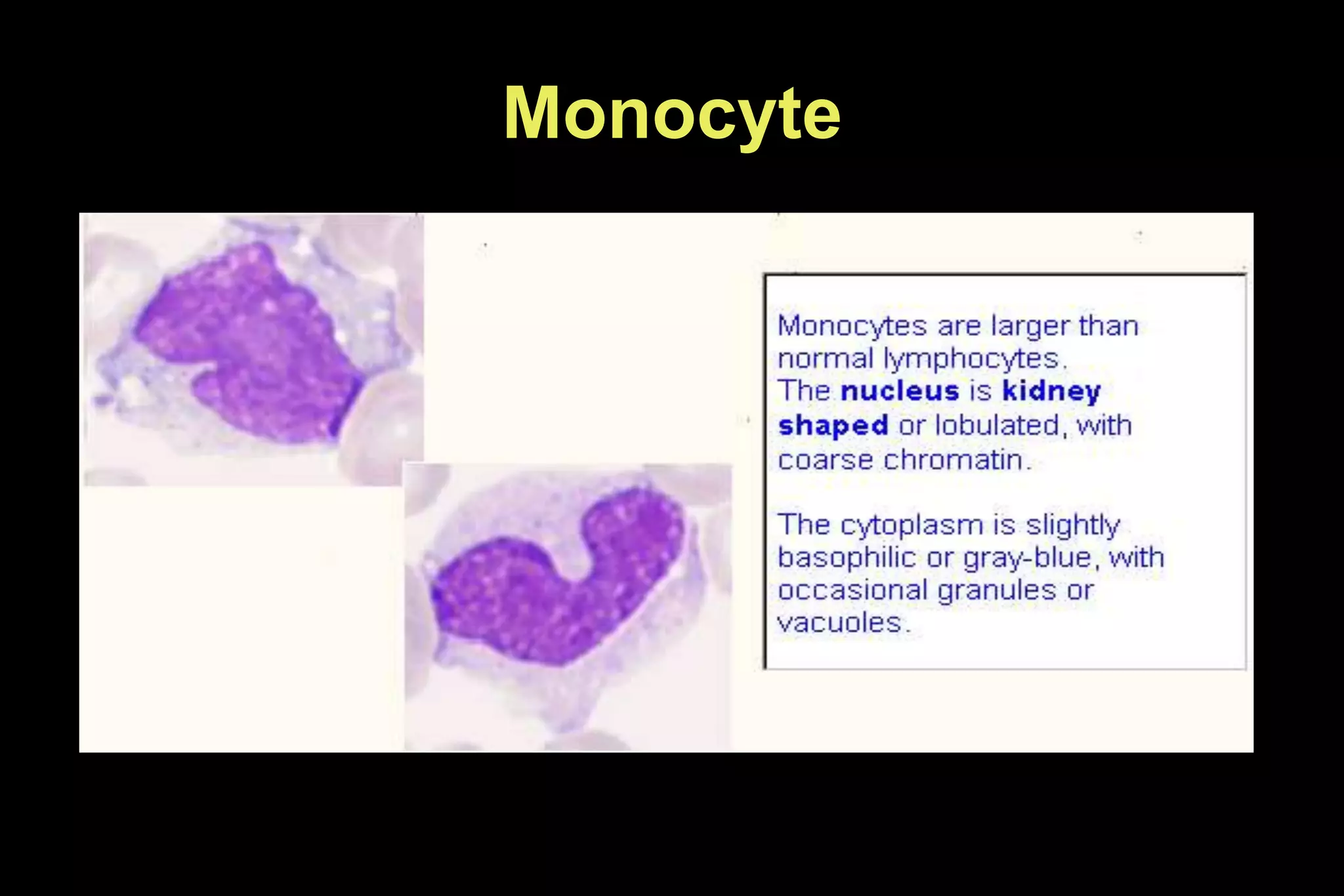 Monocyte
 