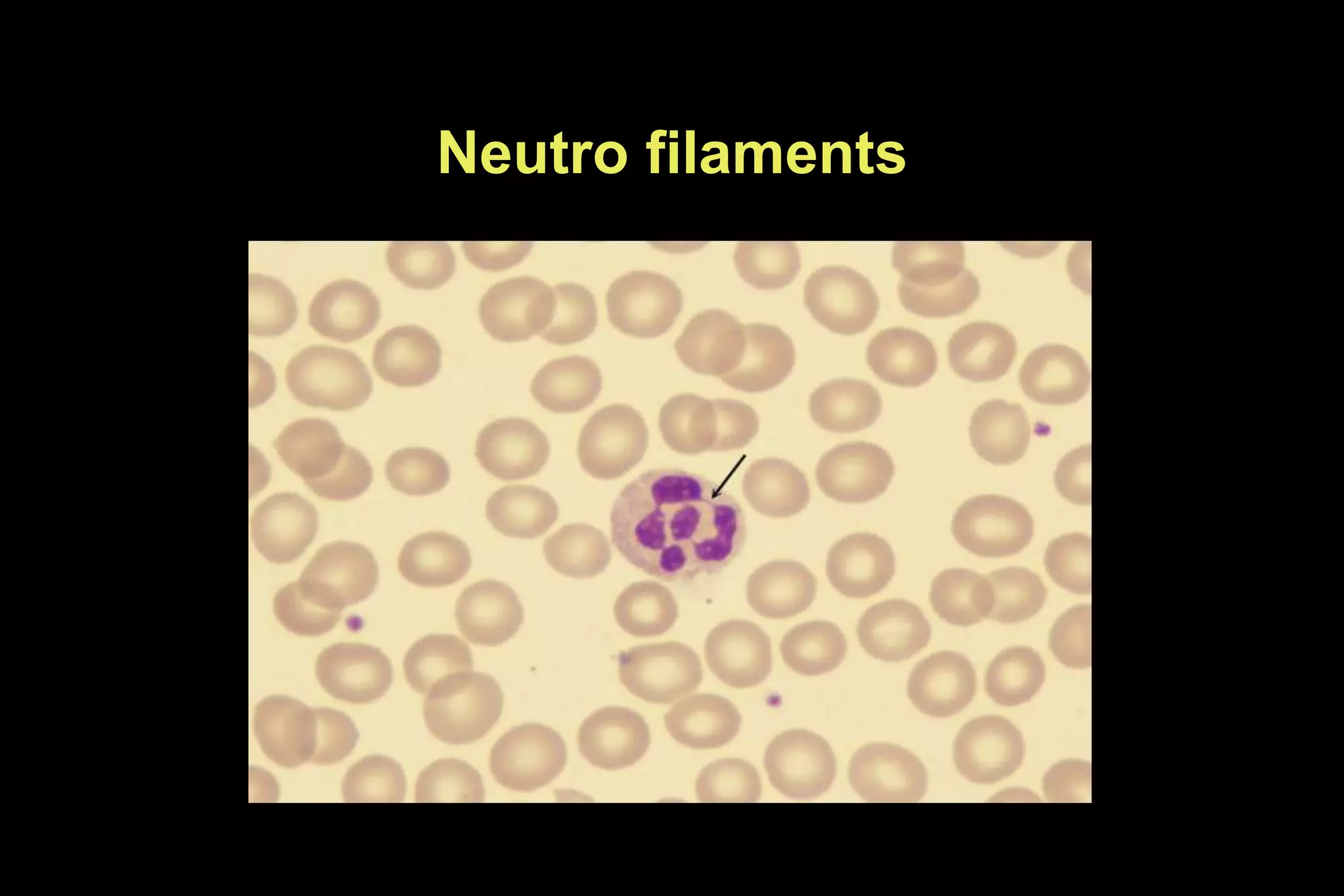 Neutro filaments
 
