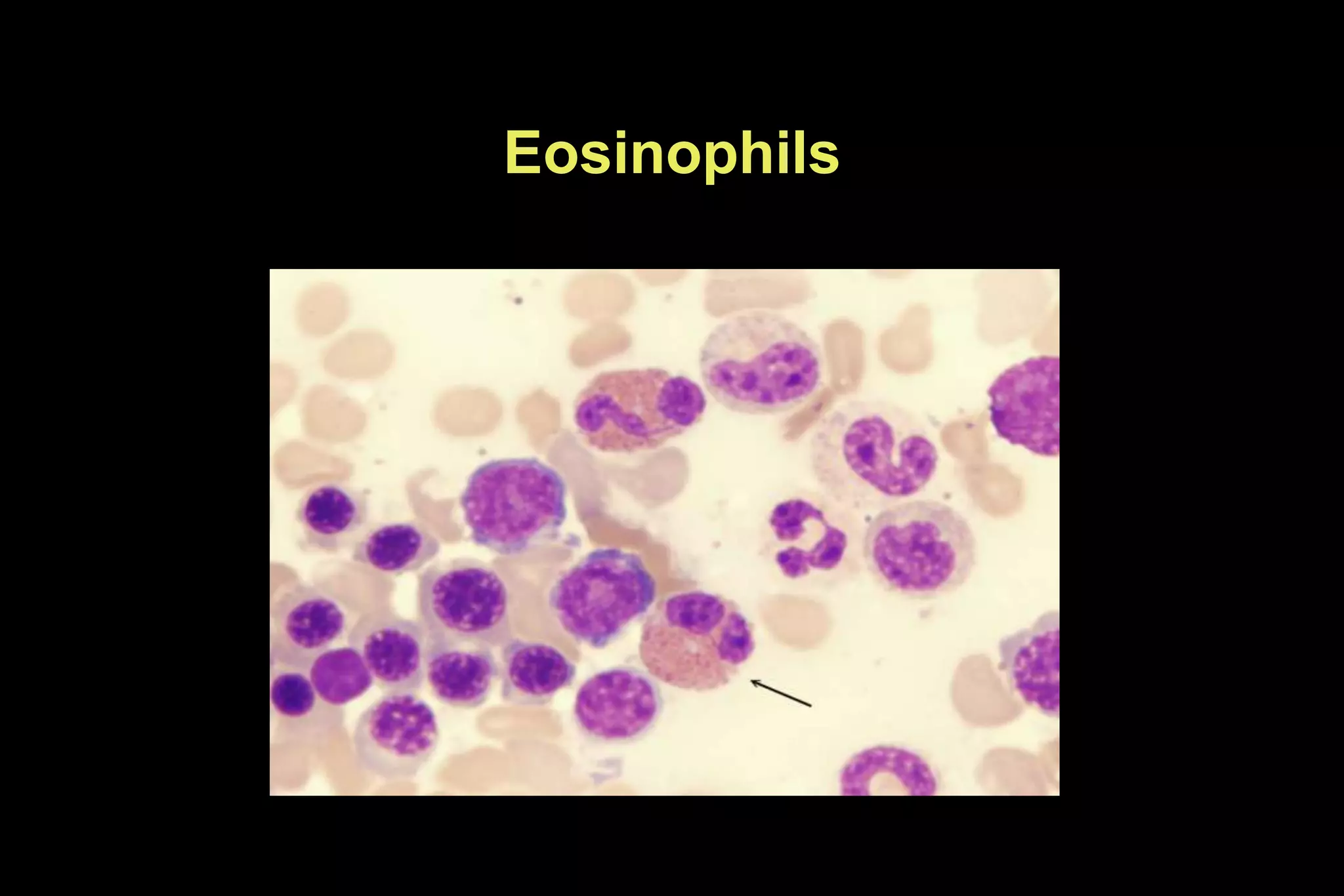 Eosinophils
 