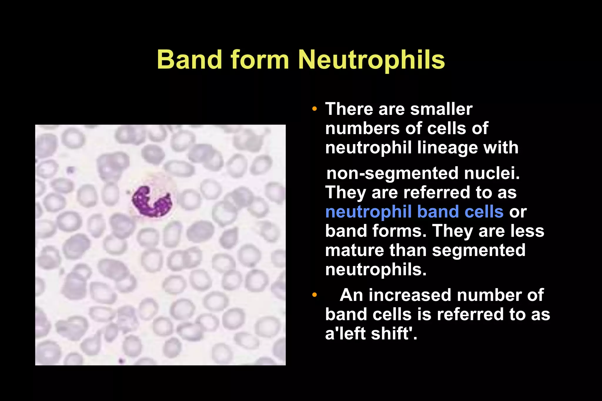 Band form Neutrophils
• There are smaller
numbers of cells of
neutrophil lineage with
non-segmented nuclei.
They are referred to as
neutrophil band cells or
band forms. They are less
mature than segmented
neutrophils.
• An increased number of
band cells is referred to as
a'left shift'.
 