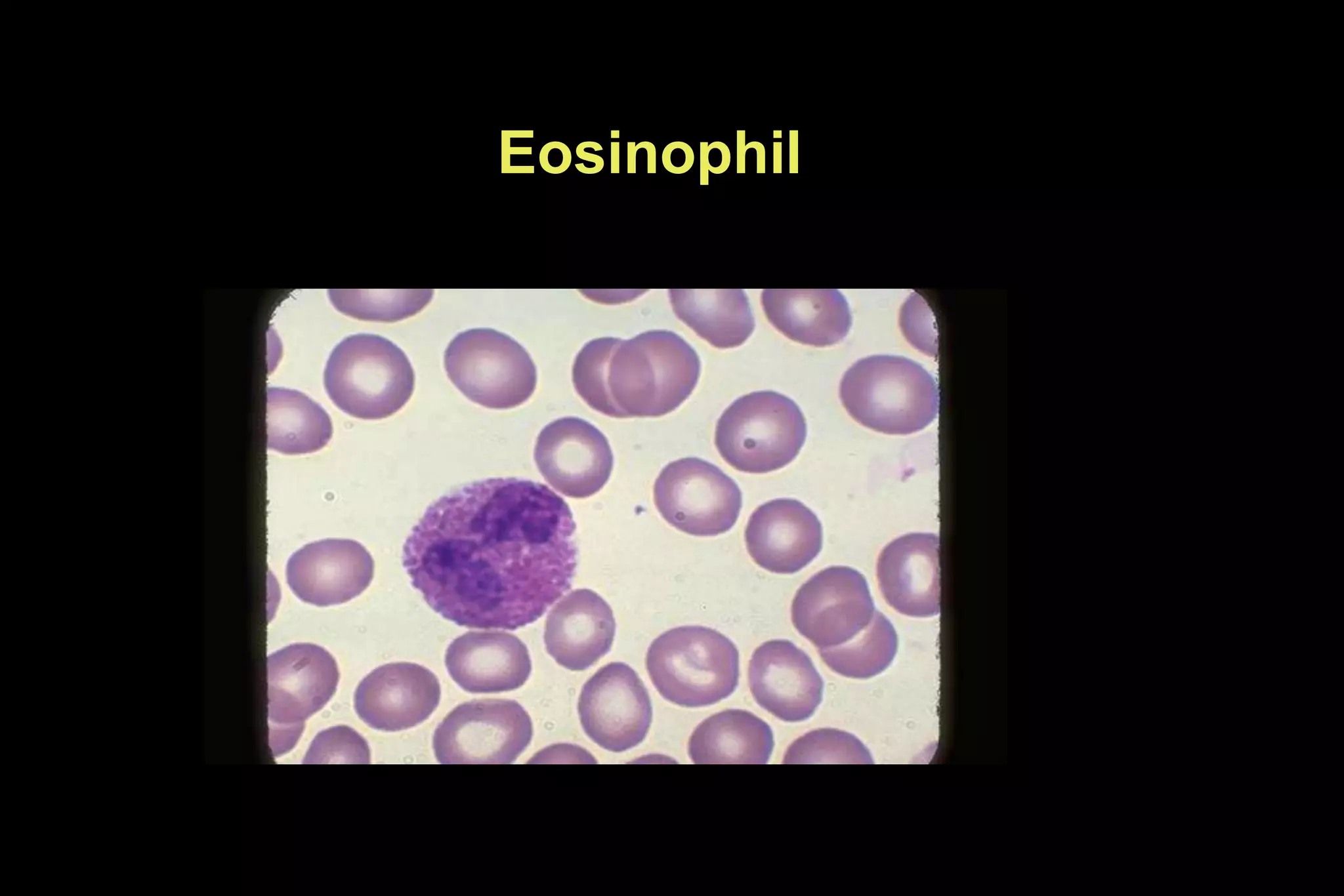 Eosinophil
 