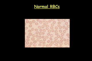Blood cell morphology.ppt