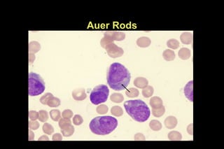 Aor Rods Blood cell morphology.ppt