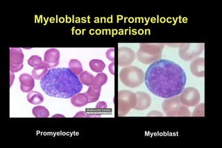 Promyelo Blood cell morphology.ppt