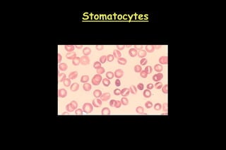 Stomatocytes
 