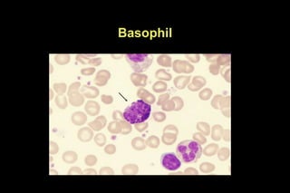 Basophil
 