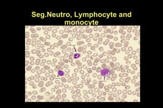 Seg.Neutro, Lymphocyte and
monocyte
 