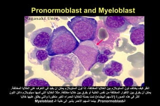 Pronormoblast and Myeloblast
‫ا‬ ‫على‬ ‫التعرف‬ ‫في‬ ‫يفيد‬ ‫ان‬ ‫يمكن‬ ‫الستوبالزم‬ ‫لون‬ ‫إذا‬ ،‫المختلفة‬ ‫الخاليا‬ ‫بين‬ ‫الستوبالزم‬ ‫لون‬ ‫يختلف‬ ‫كيف‬ ‫انظر‬
‫المختلفة‬ ‫لخاليا‬
.
‫مختلفة‬ ‫خاليا‬ ‫بين‬ ‫يفرق‬ ‫أو‬ ‫الخلية‬ ‫نفس‬ ‫من‬ ‫المختلفة‬ ‫األطوار‬ ‫بين‬ ‫يفرق‬ ‫أن‬ ‫يمكن‬
.
‫سيت‬ ‫لديها‬ ‫التي‬ ‫الخاليا‬ ‫مثال‬
‫اللون‬ ‫داكن‬ ‫وبالزم‬
‫الصورة‬ ‫هذه‬ ‫في‬ ‫أكثر‬
(
‫ال‬ ‫األسهم‬
‫بيض‬
‫اء‬
)
‫خاليا‬ ‫عليها‬ ‫يطلق‬ ‫والتي‬ ‫متطورة‬ ‫الغير‬ ‫الحمراء‬ ‫للخاليا‬ ‫بصلة‬ ‫تمت‬
‫الـ‬
Pronormoblast
.
‫الـ‬ ‫خلية‬ ‫الى‬ ‫يشير‬ ‫األحمر‬ ‫السهم‬ ‫بينما‬
Myeloblast
 