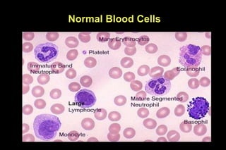 Normal Blood Cells
 