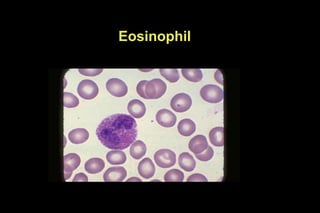 Eosinophil
 