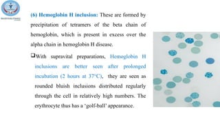 Blood cell morphology in health and disease.pptx
