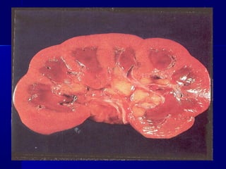 Blood cicrulation disturbanses 1