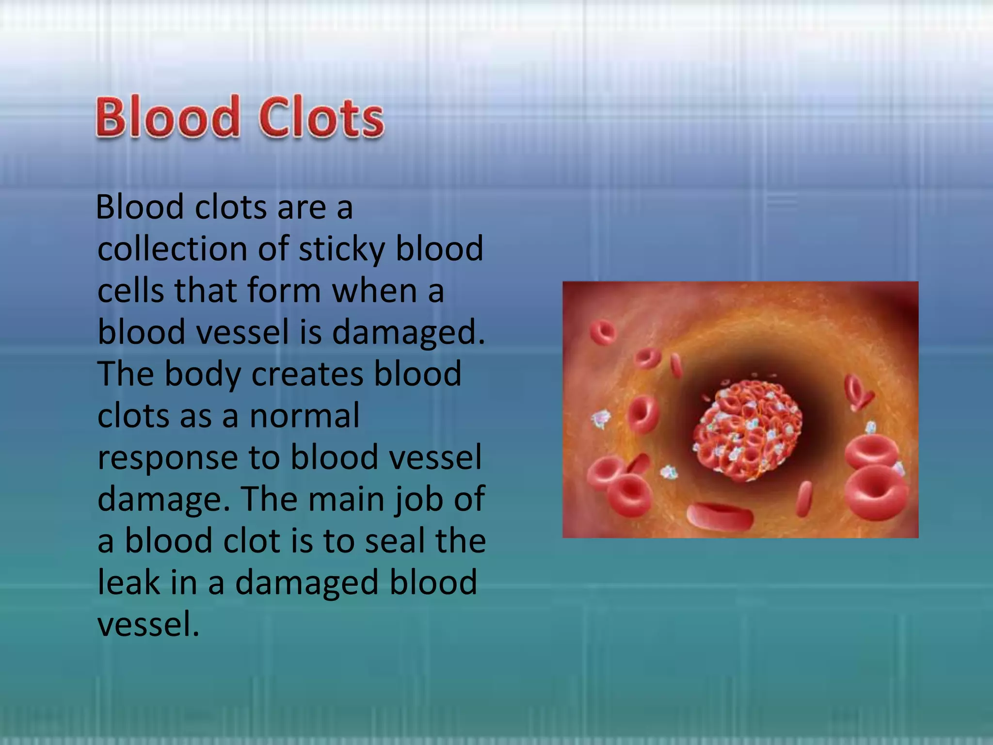 Blood Clots in Brain