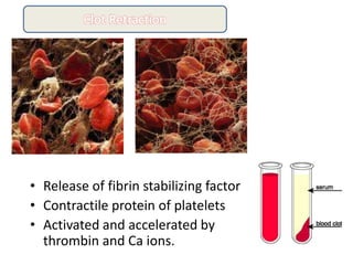 • Release of fibrin stabilizing factor
• Contractile protein of platelets
• Activated and accelerated by
thrombin and Ca ions.
 
