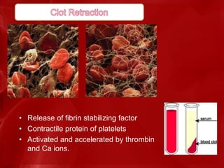 • Release of fibrin stabilizing factor
• Contractile protein of platelets
• Activated and accelerated by thrombin
and Ca ions.
 