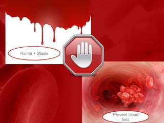 Haima + Stasis
Prevent blood
loss
 