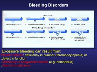 BLOOD COAGULATION THE ABALITY OF BLOOD TO FREEZE.PPTX
