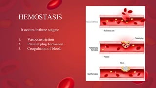 It occurs in three stages:
1. Vasoconstriction
2. Platelet plug formation
3. Coagulation of blood.
HEMOSTASIS
 