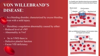 VON WILLEBRAND’S
DISEASE:
• Is a bleeding disorder, characterized by excess bleeding
even with a mild injury.
• Hereditary coagulation abnormality caused by either:
– Reduced level of vWF
– Abnormality in Vwf
• So in VWD there is:
– Defective platelet function
– Factor VIII deficiency
 
