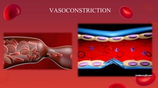 VASOCONSTRICTION
 