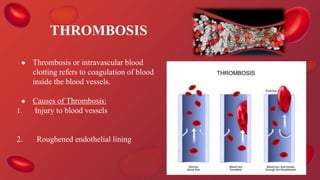 THROMBOSIS
● Thrombosis or intravascular blood
clotting refers to coagulation of blood
inside the blood vessels.
● Causes of Thrombosis:
1. Injury to blood vessels
2. Roughened endothelial lining
 