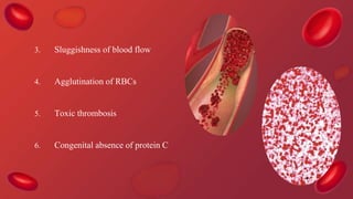 3. Sluggishness of blood flow
4. Agglutination of RBCs
5. Toxic thrombosis
6. Congenital absence of protein C
 