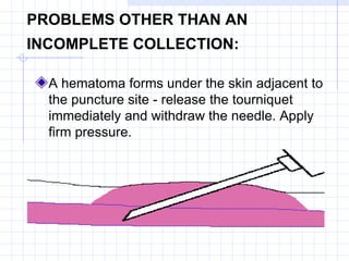 PROBLEMS OTHER THAN AN INCOMPLETE COLLECTION:   A hematoma forms under the skin adjacent to the puncture site - release the tourniquet immediately and withdraw the needle. Apply firm pressure. 