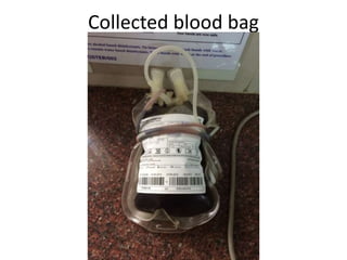 Collected blood bag
 