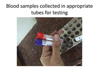 Blood samples collected in appropriate
tubes for testing
 