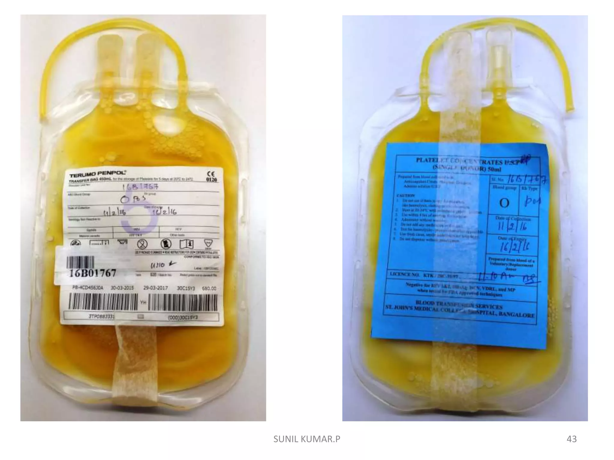 Component Prep Blood component preparation | PPTX