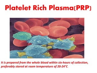 Platelet Rich Plasma(PRP)
It is prepared from the whole blood within six-hours of collection,
preferably stored at room temperature of 20-24°C.
 