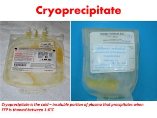 Cryoprecipitate
Cryoprecipitate is the cold – insoluble portion of plasma that precipitates when
FFP is thawed between 1-6°C
 