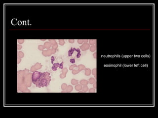 Cont.

neutrophils (upper two cells)
eosinophil (lower left cell)

 