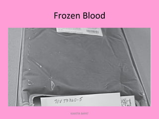 Frozen	
  Blood	
  
KAWITA BAPAT
 