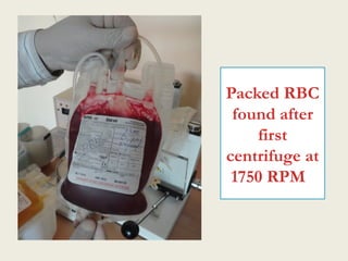 Packed Rbc Machine BLOOD COMPONENT SEPARATION and its use.pptx